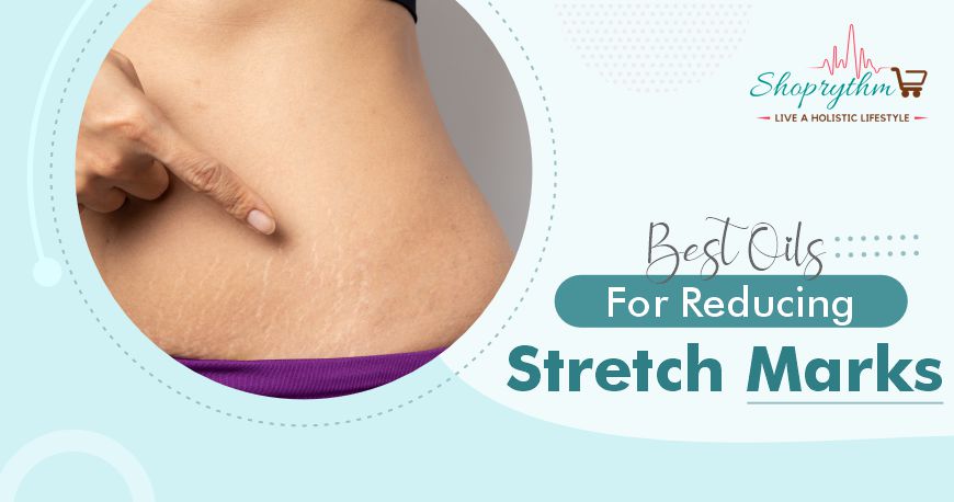 Which Are The Best Oils For Stretch Marks Reduction?