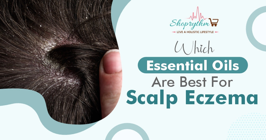 Essential Oils You Can Use For Scalp Eczema
