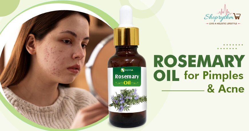 Rosemary Oil for Pimples