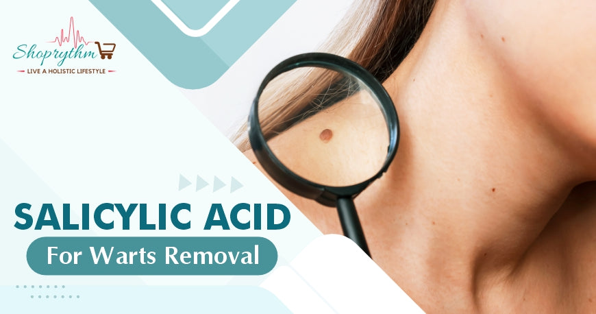 salicylic acid for warts removal