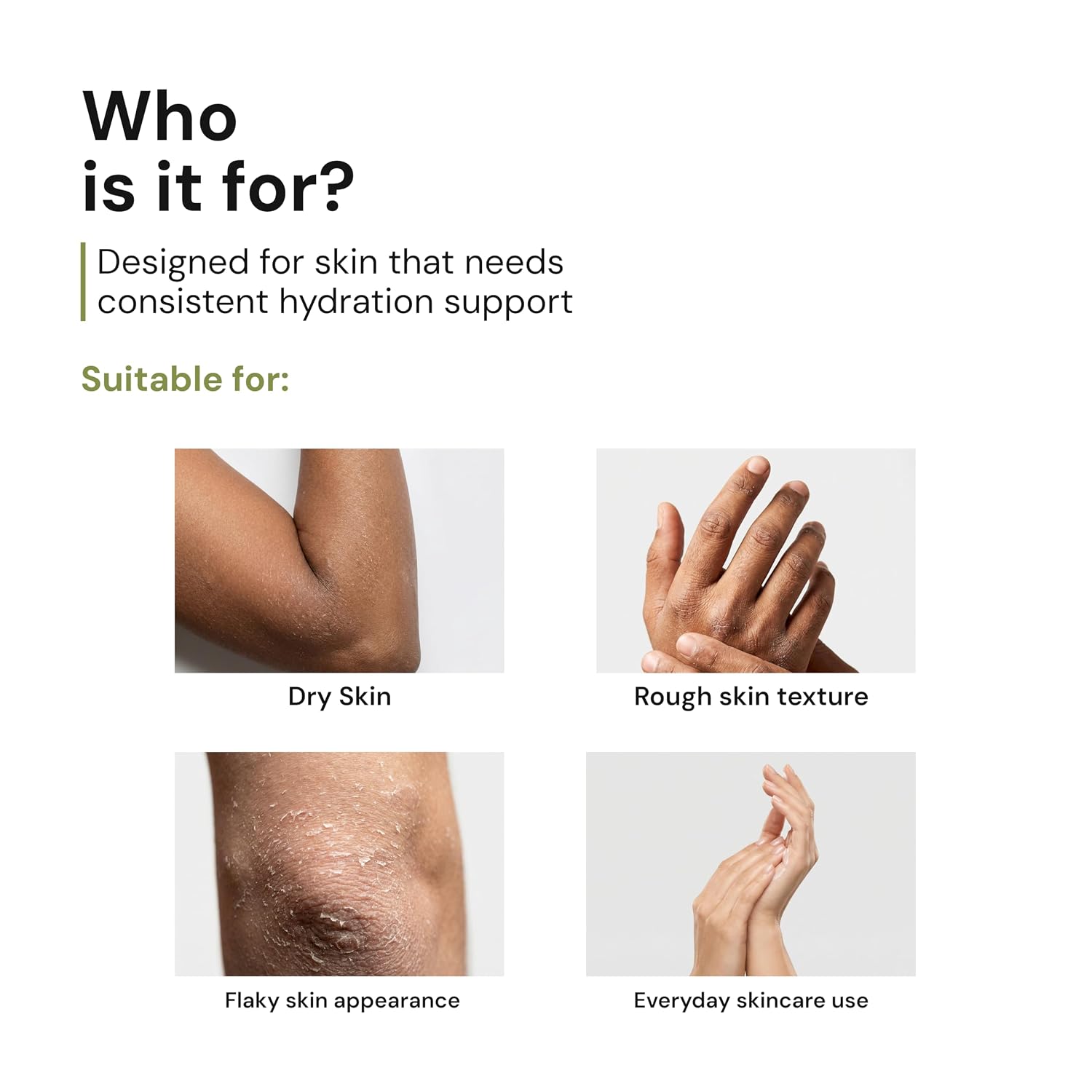 Parasoft Cream for Dry Skin