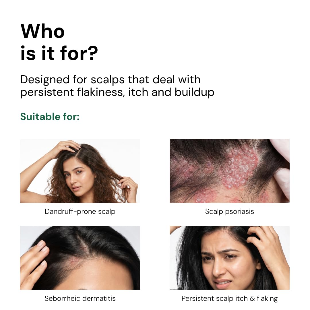 Uses Scalp Psoraisis