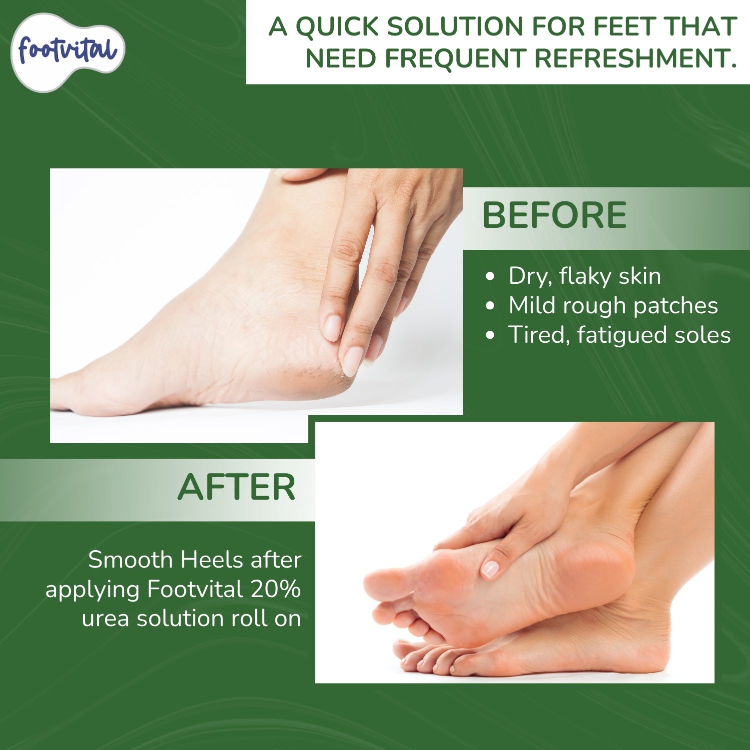 Shoprythm New Arrival,footvital Roll on 20% urea solution