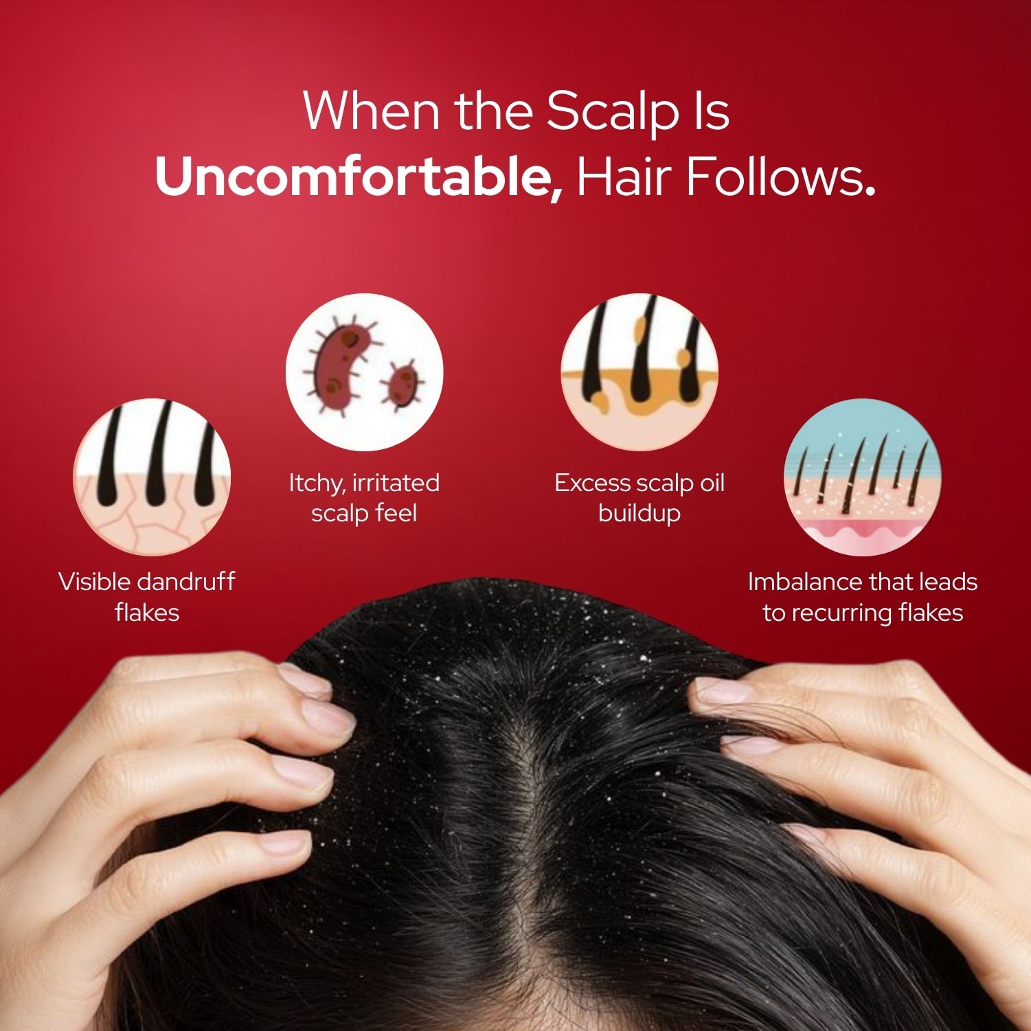 Shoprythm New Arrival Getrid anti dandruff shampoo