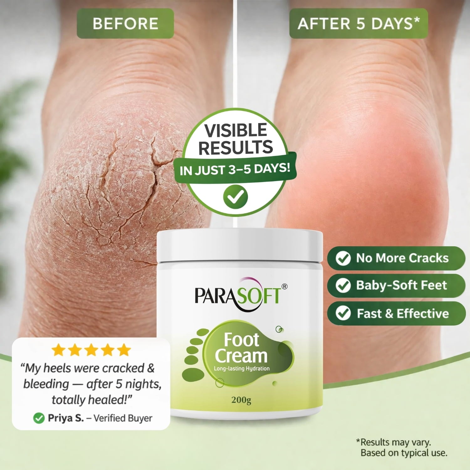 Shoprythm New arrival,Parasoft Parasoft Foot Cream 200gm