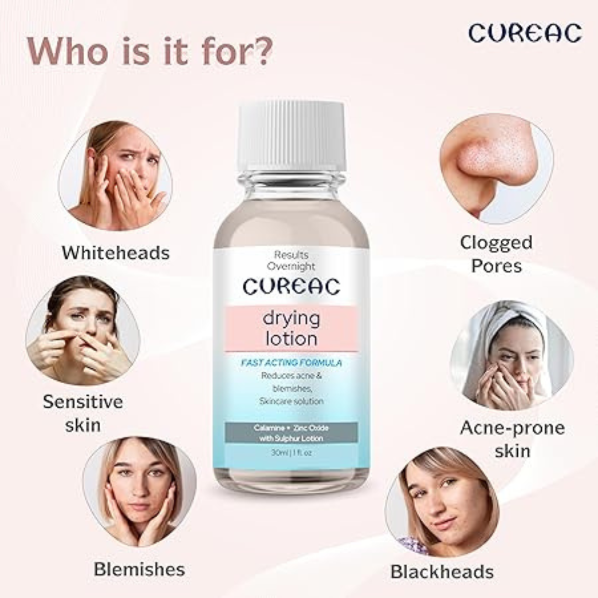 Cureac Drying Lotion